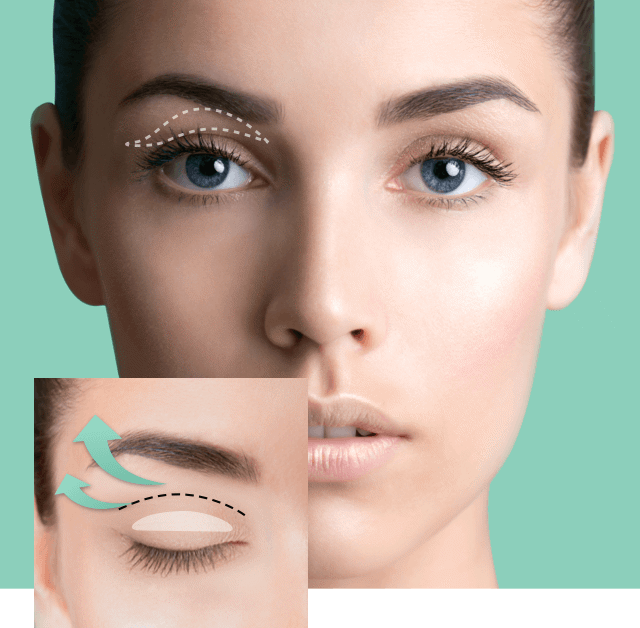 Contours Rx Lids by Design Eyelid Reviews – Your Way to younger